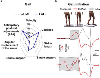 Spinal Cord Stimulation for Freezing of Gait: From Bench to Bedside